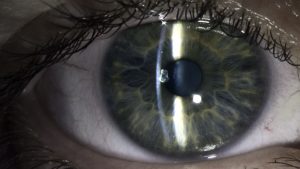 Close-up on a human eye